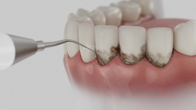 Trusted Teeth Cleaning And Checkup service in Campbellsburg, KY - Dentist Open Now